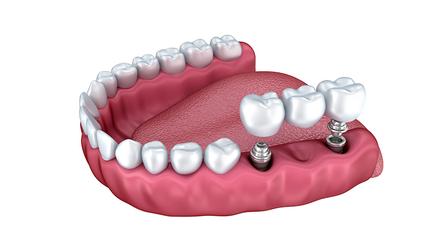 Medicina estetica - Studio dentistico a Levanto | Studio dentistico Vezzi